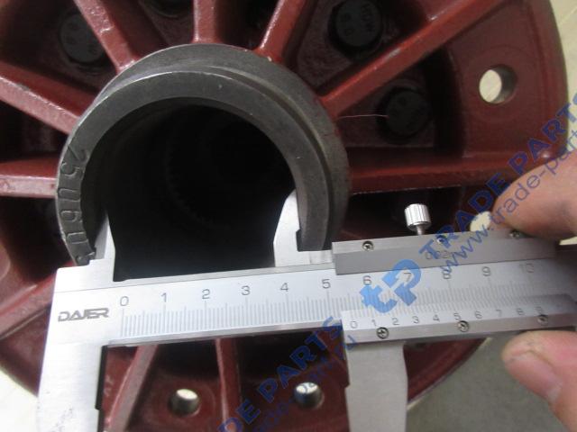 Реальная фотография дифференциал 860115256/82214207 xcmg lw300f